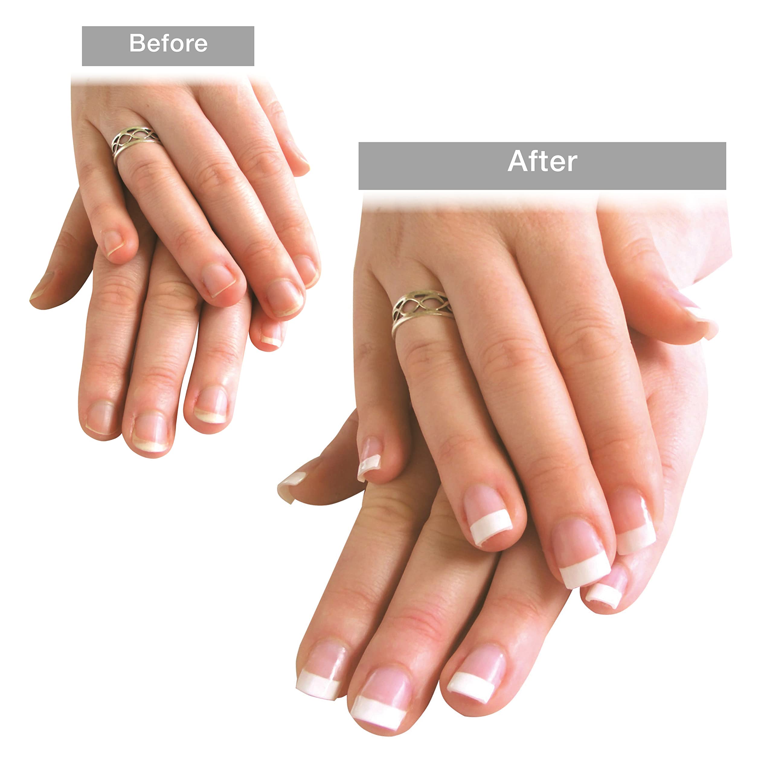 rio-uv-gel-nagelverl-ngerungs-set-komplettset-mit-uv-gel-100-tipps-und-zubeh-r-f image 2