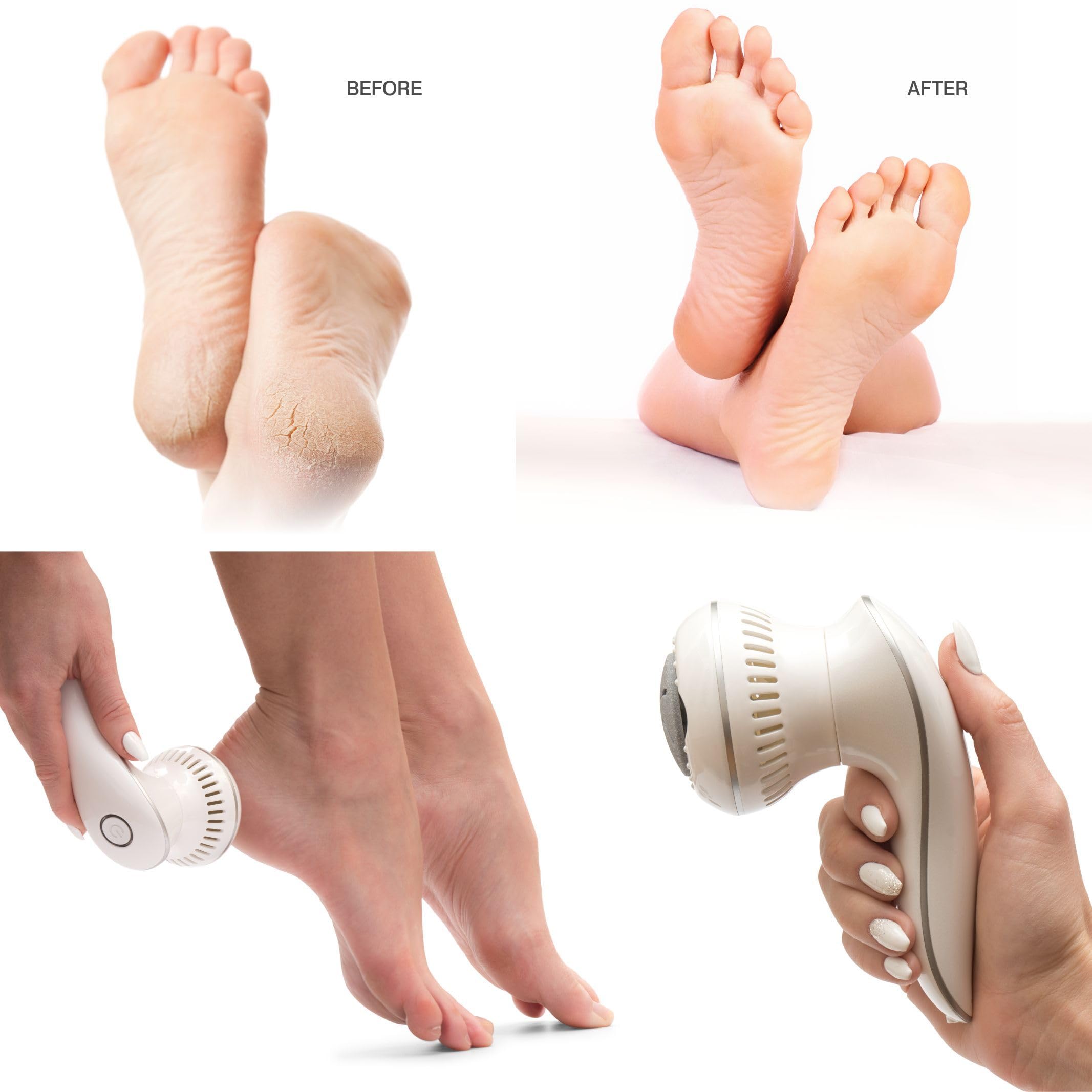 rio-60-second-spa-pedi-elektrische-pedik-re-fu-feile-hornhautentferner-mit-3-auf image 7