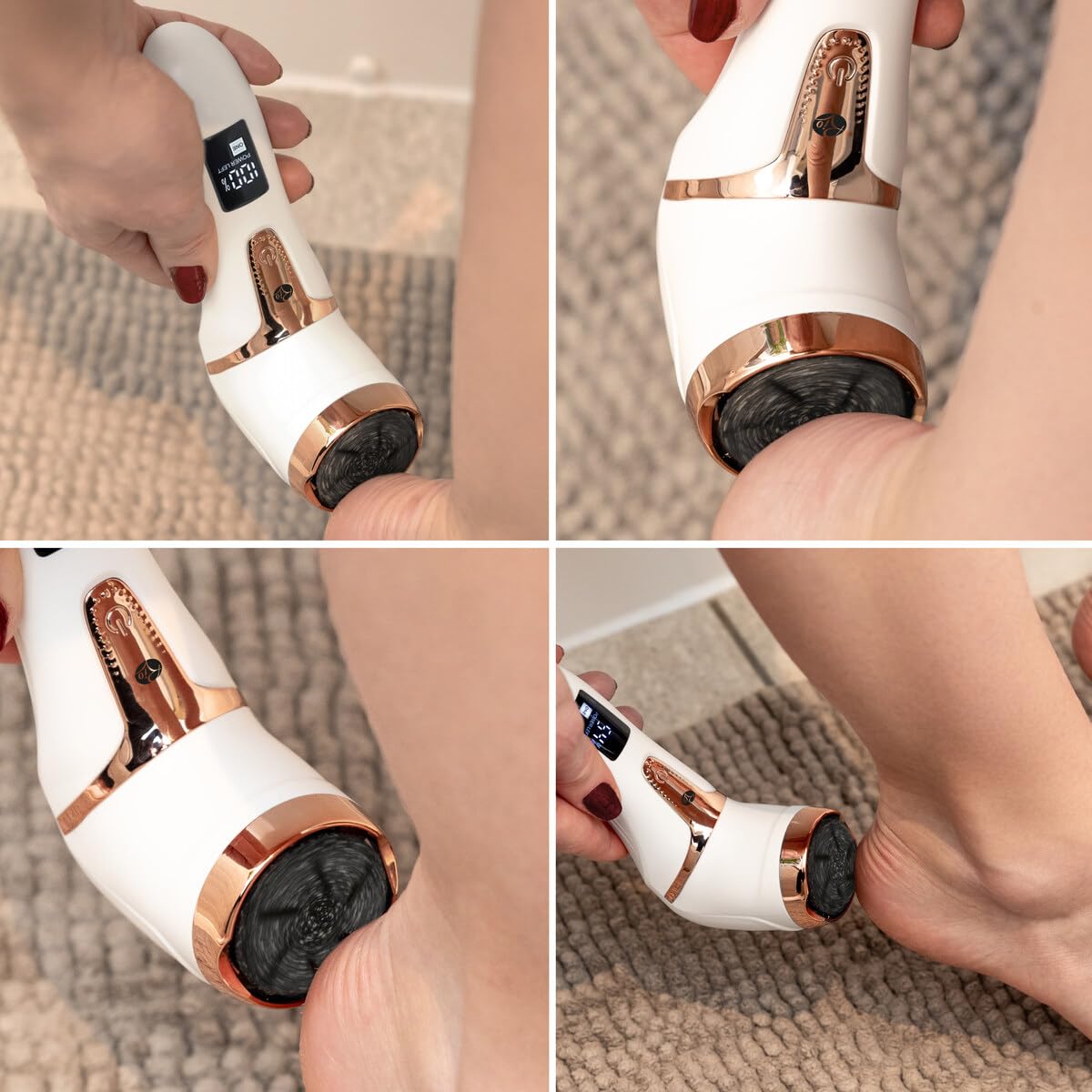 rio-go-smooth-elektrische-fu-feile-mit-vakuumfunktion-hornhautentferner-usb-wied image 2