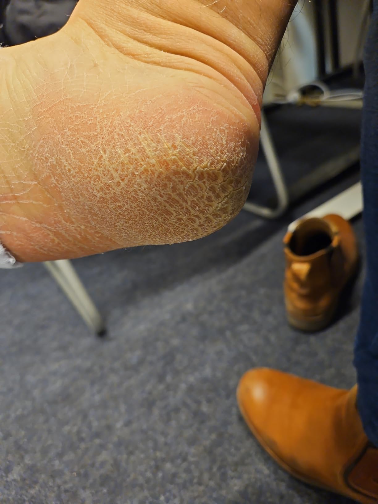 Endlich weiche Füße ohne Pedicure-Termine