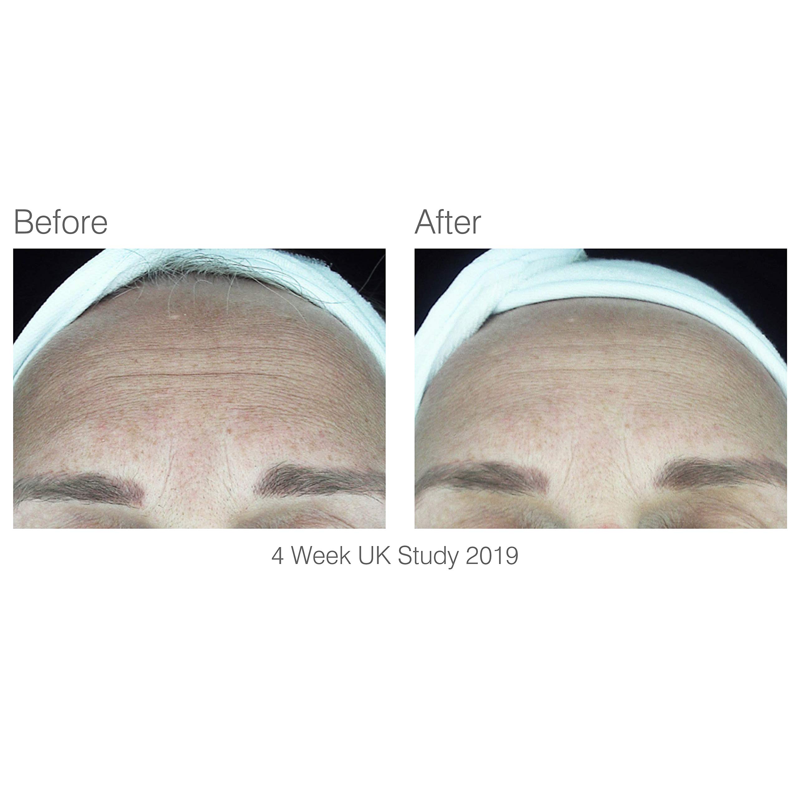 rio-facelite-beauty-boosting-led-gesichtsmaske-mit-klinisch-erprobten-wellenl-ng image 6