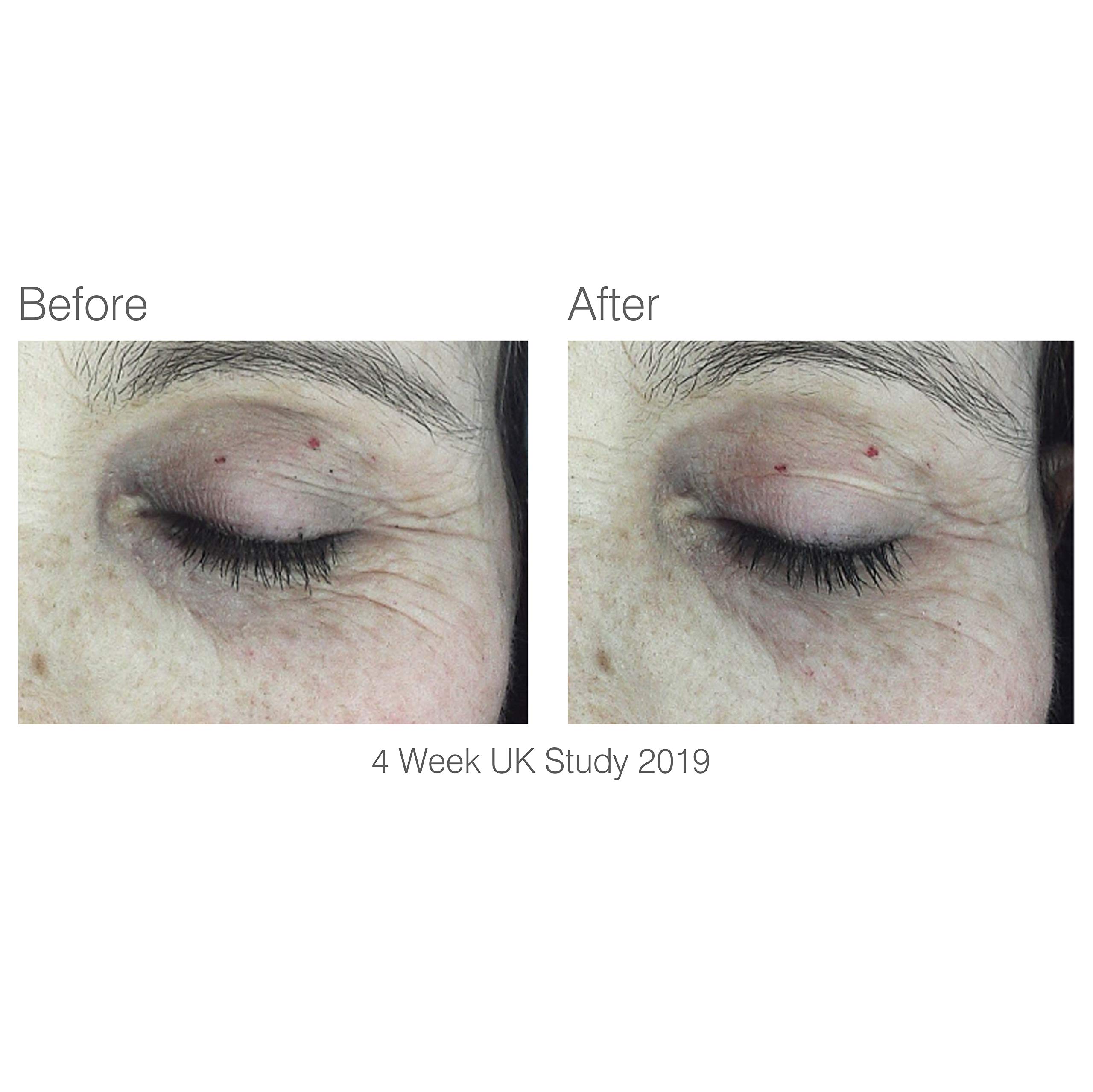 rio-facelite-beauty-boosting-led-gesichtsmaske-mit-klinisch-erprobten-wellenl-ng image 5