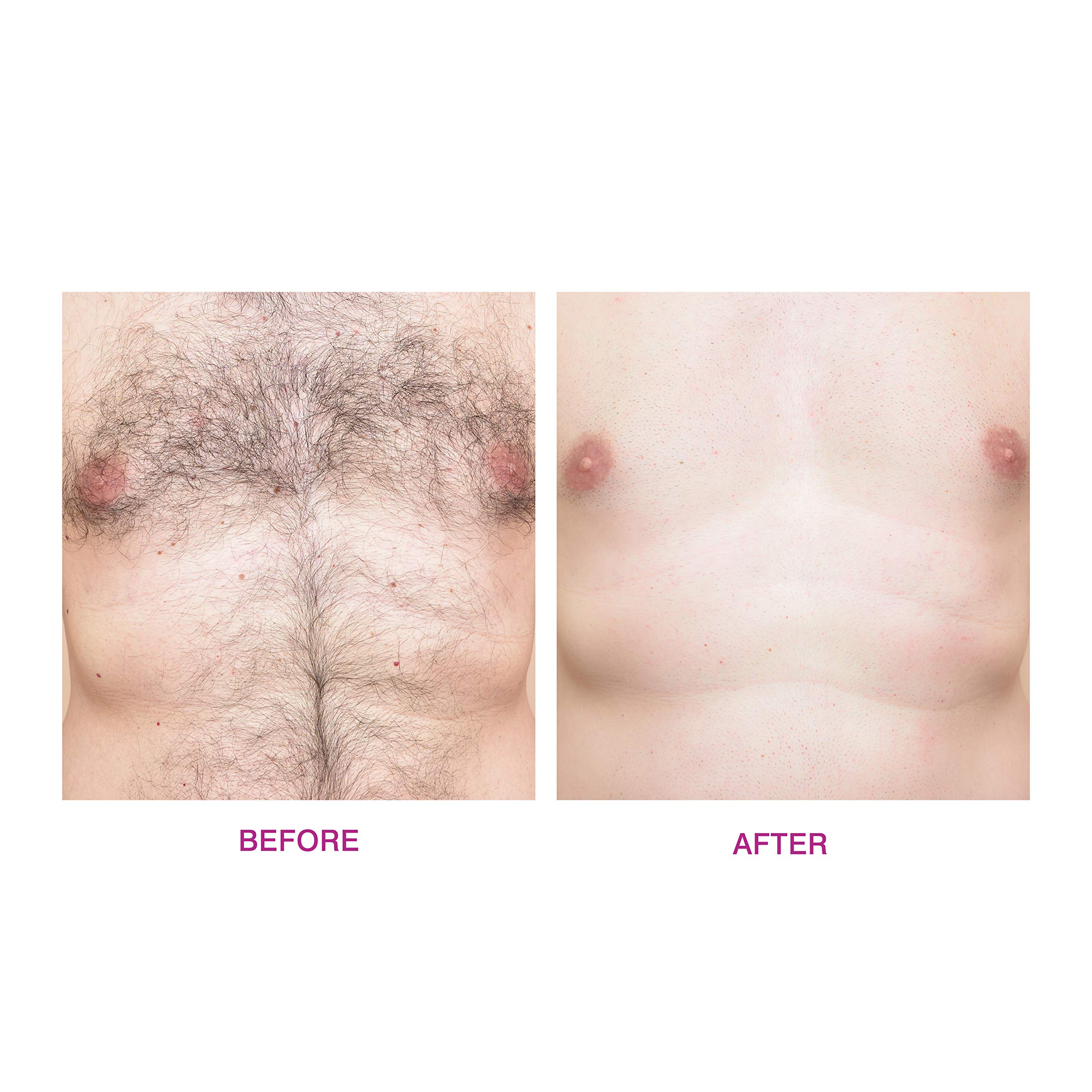 rio-total-body-waxing-komplett-wachsset-mit-heizger-t-weichwachs-und-hartwachs-f image 6