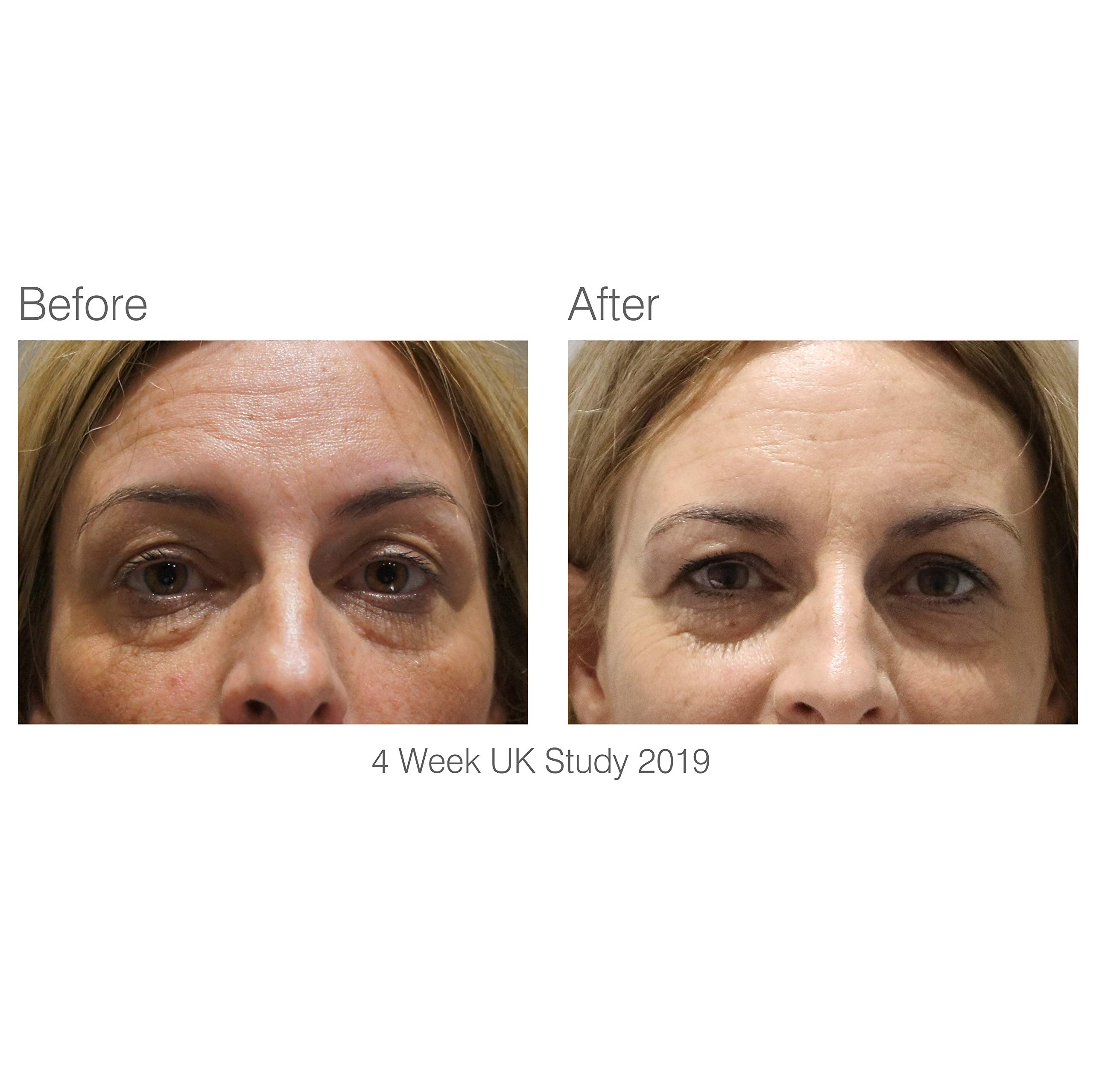 rio-facelite-beauty-boosting-light-therapy-led-gesichtsmaske image 7