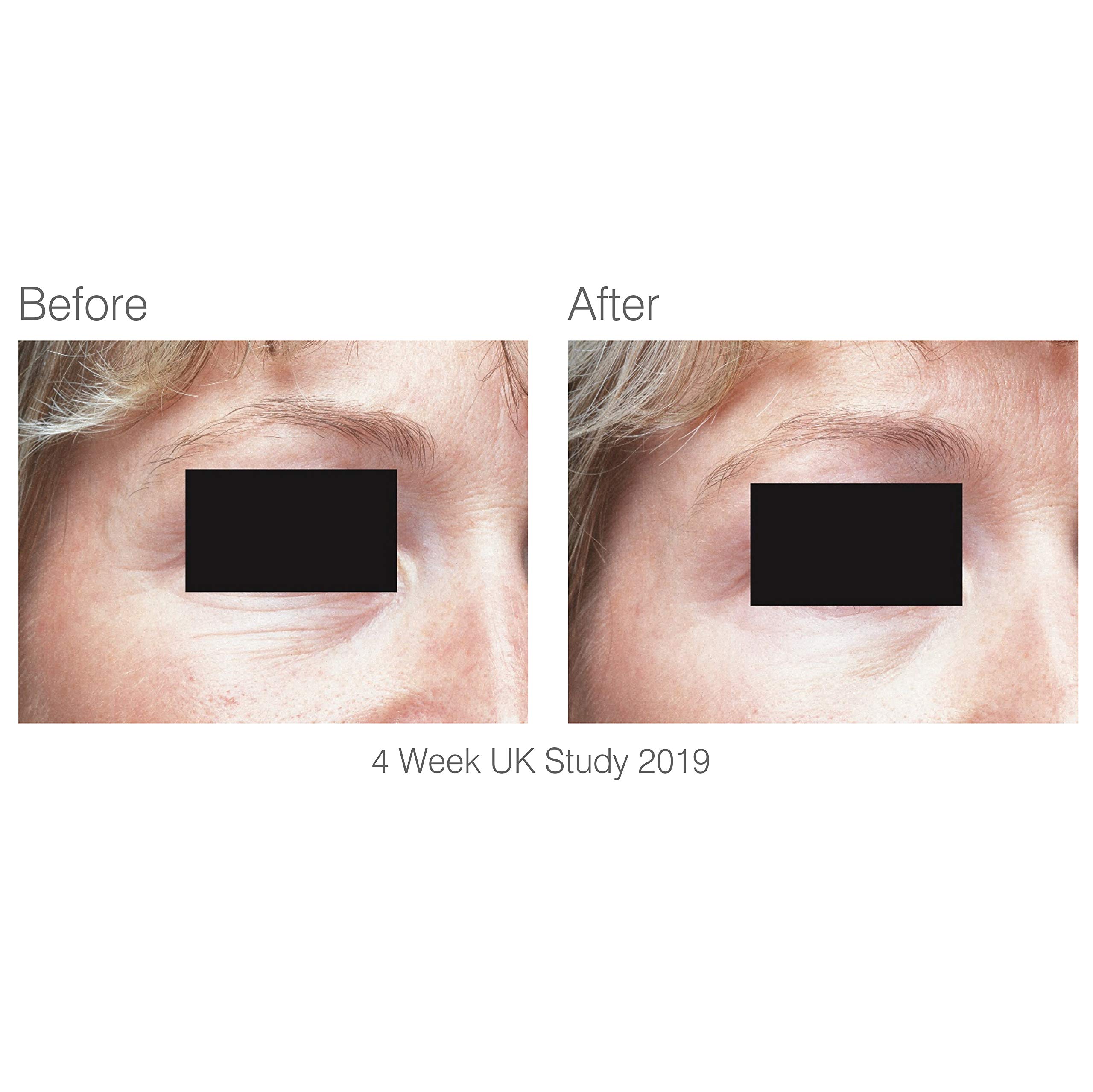 rio-facelite-beauty-boosting-light-therapy-led-gesichtsmaske image 6